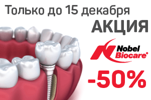 Скидка 50% на имплантаты премиум - класса Nobel Biocare!