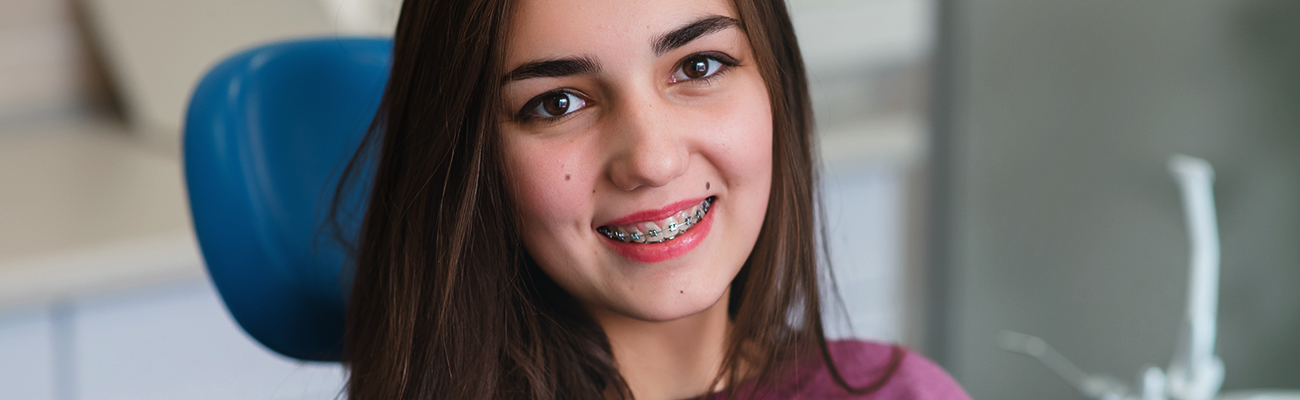 установка брекетов