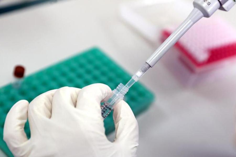 В медицинском центре Никор-Мед Андреевка появился анализ на коронавирус COVID-19