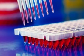 Проведение иммунологического тестирования на антитела к SARS-CoV-2