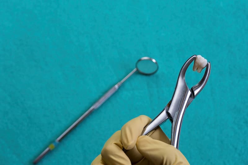 Рекомендации после удаления зуба