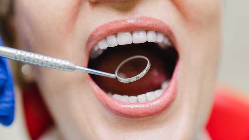 Пародонтоз