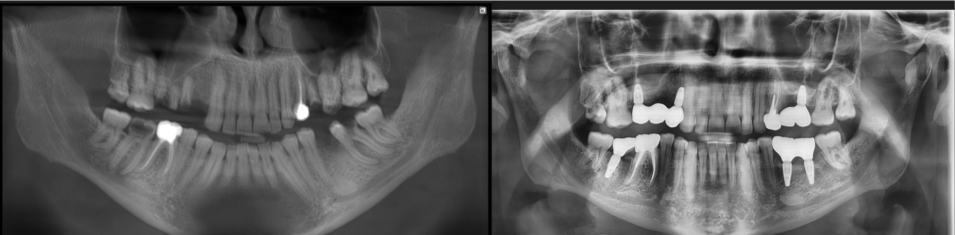 Клинический случай