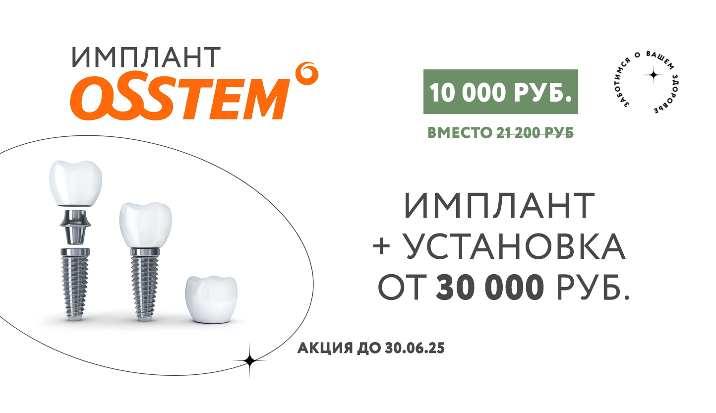 Улыбка без компромиссов: Летняя акция на импланты